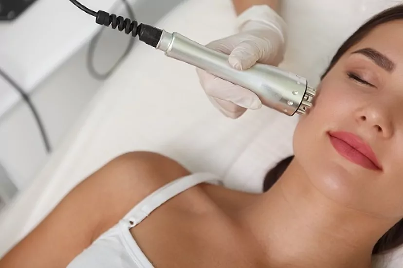 RADIO FRECUENCIA FACIAL